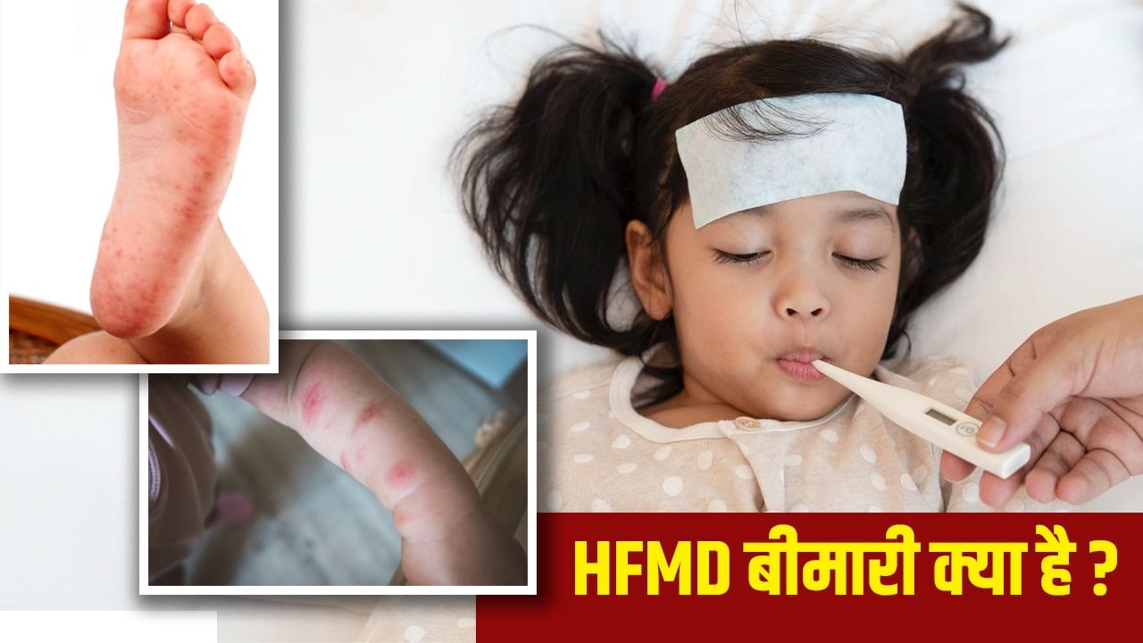क्या है Hand Foot Mouth Disease, जिससे संक्रमित हो रहे हैं बच्चे, एक्सपर्ट्स से जानें